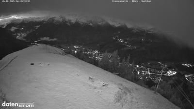 Frassenhütte – Zimba