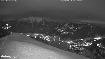 Frassenhütte – Zimba